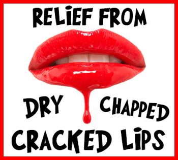 Dickinson dentist, Dr. Agee Kunjumon at Touchstone Dentistry, tells you how to relieve your dry, chapped, and cracked lips!